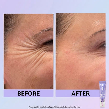 Final 3 Hours: 60%OFF🔥 Instant Lift Eye Gel for Puffiness, Bags & Dark Circles