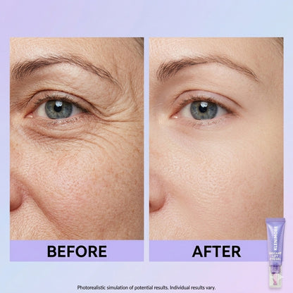 Final 3 Hours: 60%OFF🔥 Instant Lift Eye Gel for Puffiness, Bags & Dark Circles