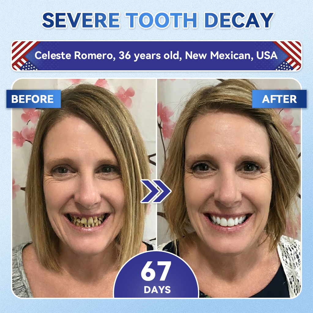 🦷 50% OFF Today🔥 – Advanced Tooth & Gum Care Strips | Whiter, Stronger, Healthier Smile