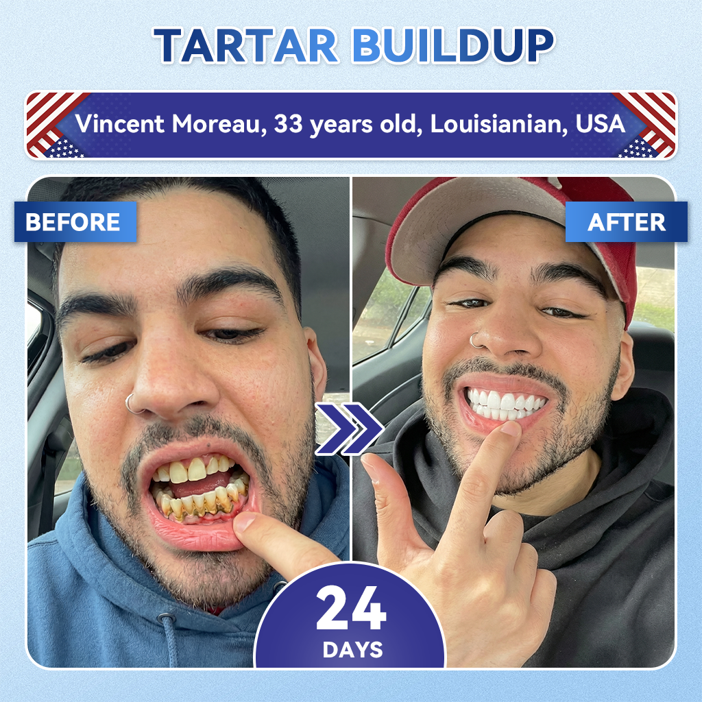 🦷 50% OFF Today🔥 – Advanced Tooth & Gum Care Strips | Whiter, Stronger, Healthier Smile