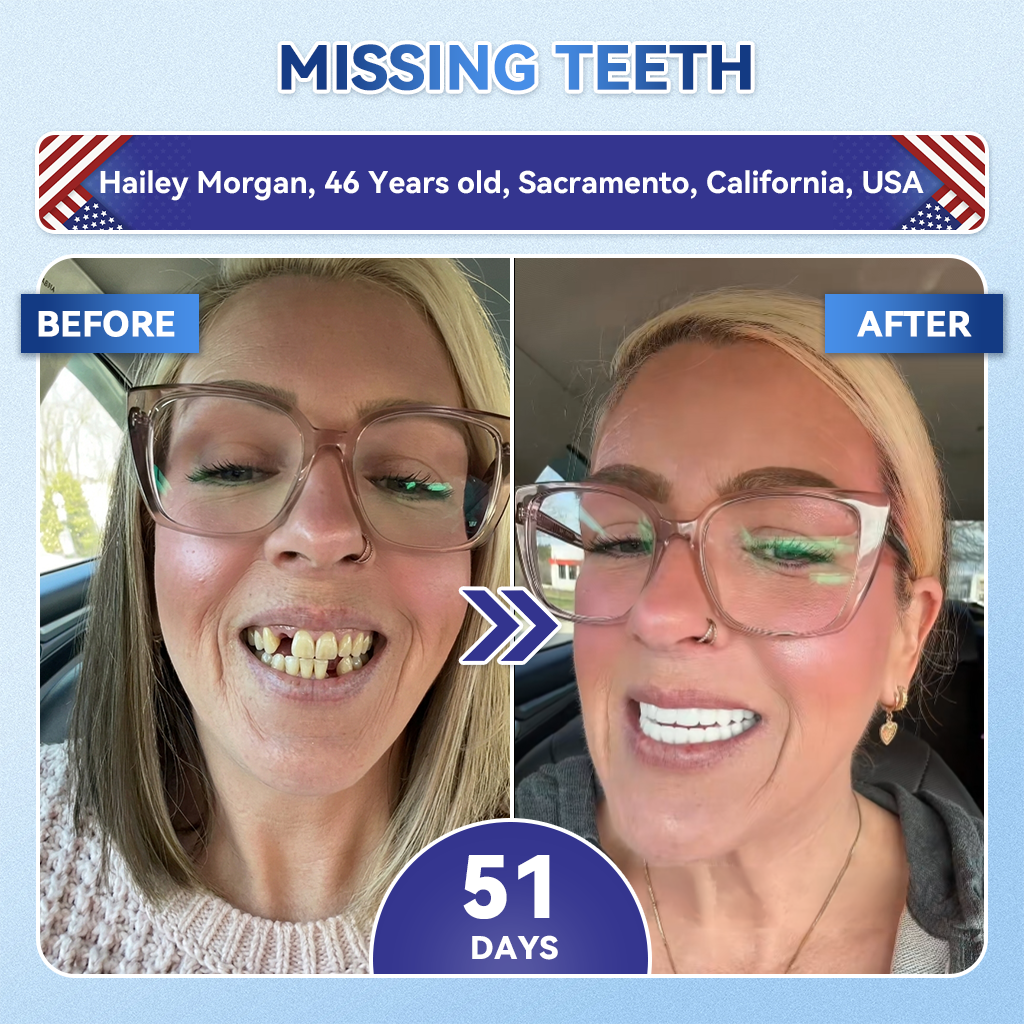 🦷 50% OFF Today🔥 – Advanced Tooth & Gum Care Strips | Whiter, Stronger, Healthier Smile