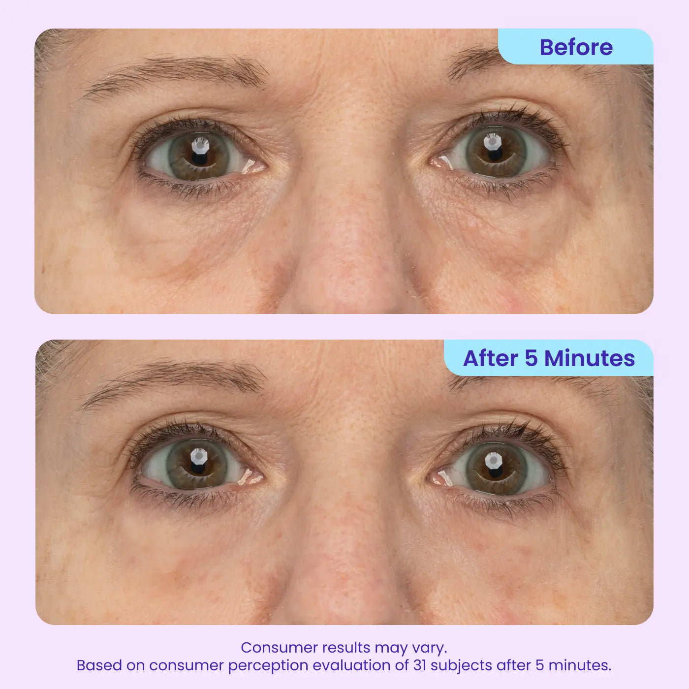 Final 3 Hours: 60%OFF🔥 Instant Lift Eye Gel for Puffiness, Bags & Dark Circles