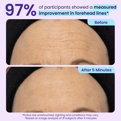 Final 3 Hours: 60%OFF🔥 Instant Lift Eye Gel for Puffiness, Bags & Dark Circles