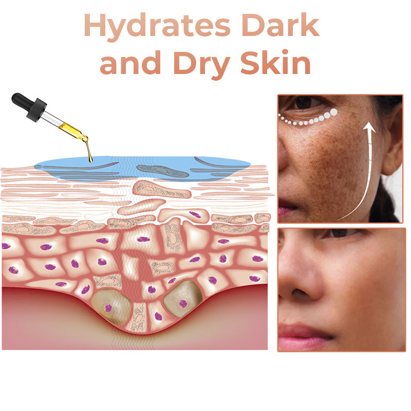 ✨Fast Dark Spot Remover-AQA™  Melanin Correcting Facial Serum(🔥Last Day Promotion 60% OFF)
